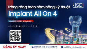 Trồng răng toàn hàm bằng kỹ thuật Implant All On 4